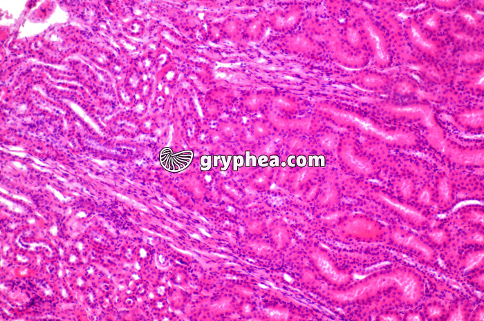 Tubules Rein x40 - gryphea.com